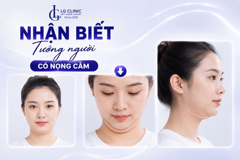 tướng phụ nữ có nọng cằm