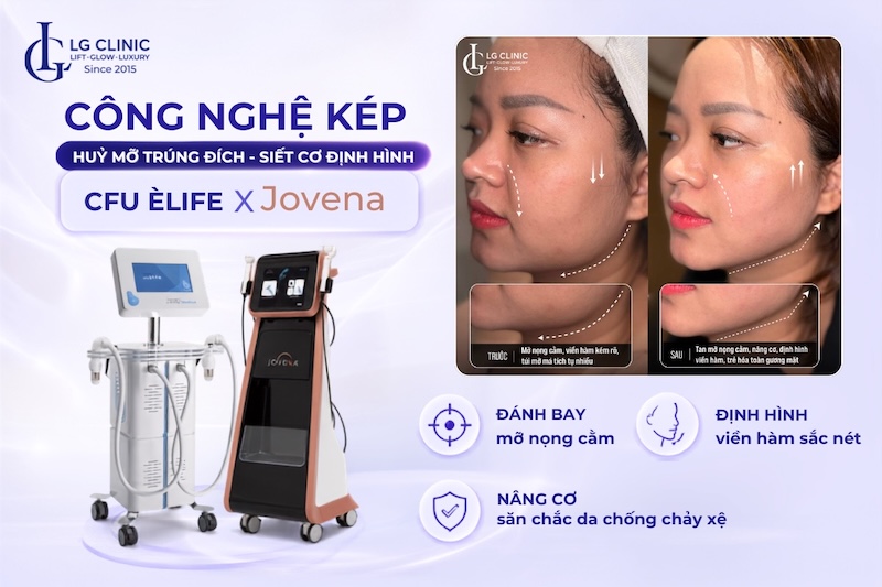 nọng cằm có tốt không