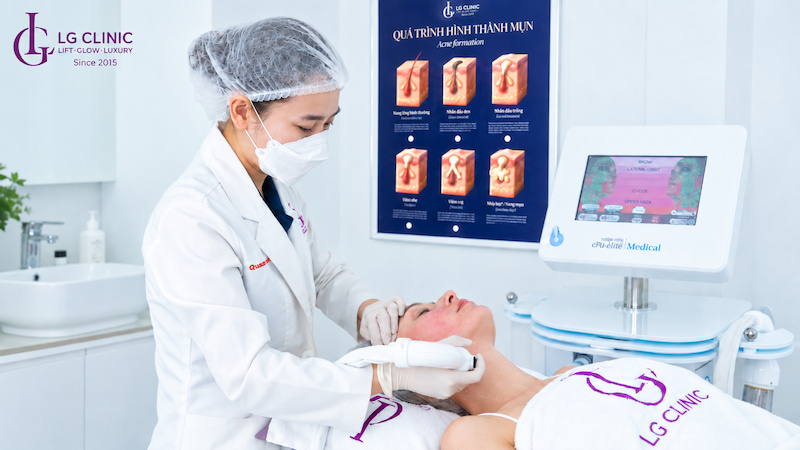 Công nghệ CFU giảm mỡ mặt