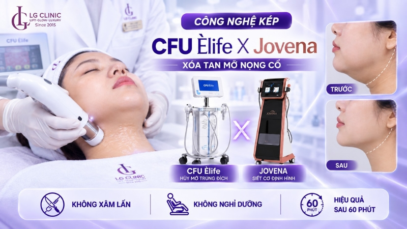 cách giảm nọng cổ bằng công nghệ kép tại LG Clinic