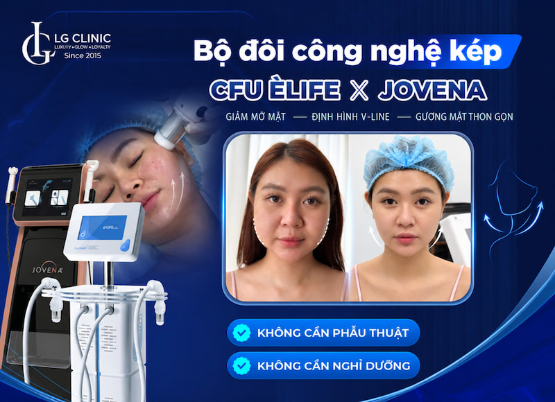 cách giảm mỡ mặt cấp tốc bằng CFU