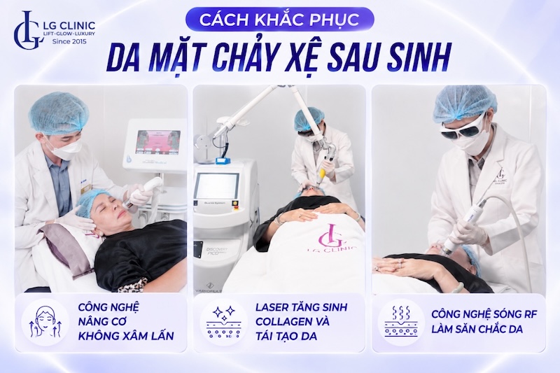 da chảy xệ sau sinh