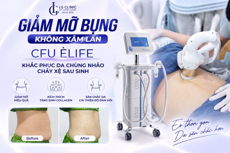khắc phục da bụng chảy xệ sau sinh