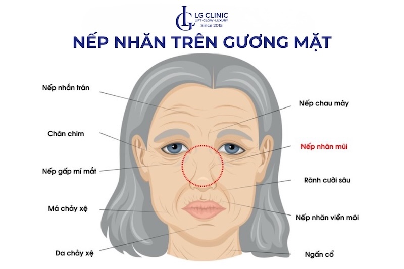 da mặt nhăn nheo