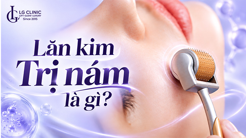 lăn kim trị nám có tốt không