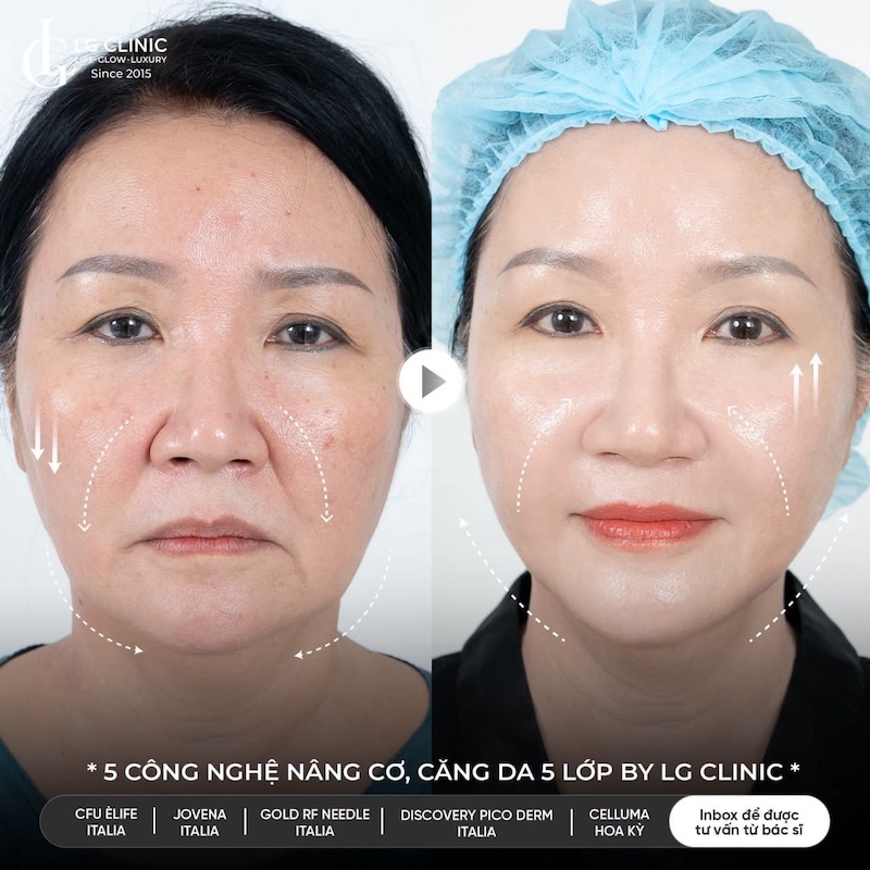 lg clinic lừa đảo