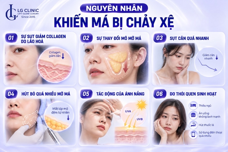 vì sao bị xệ má