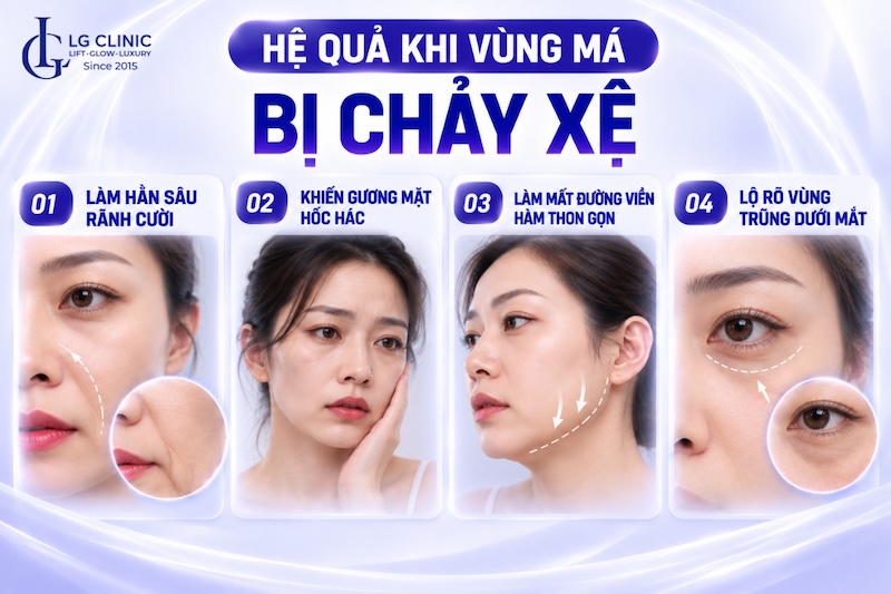 má xệ