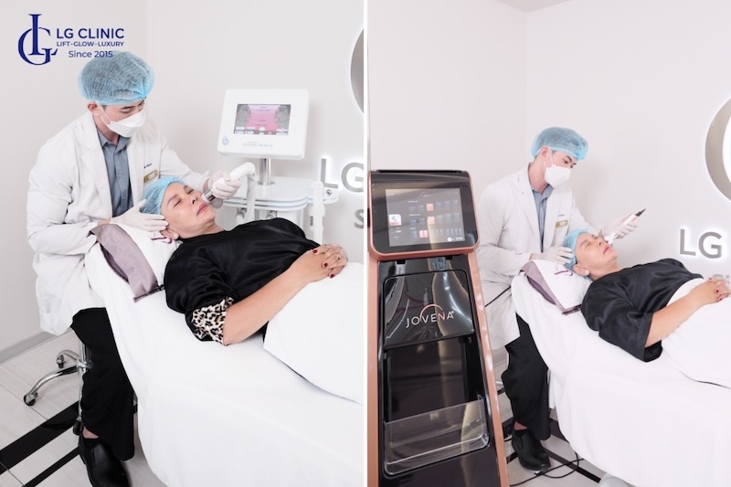 điều trị mặt bị chảy xệ 1 bên