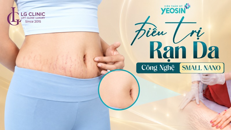 spa trị rạn da uy tín