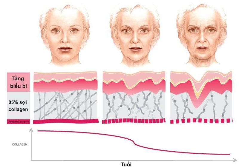 Biểu đồ collagen giảm dần theo tuổi và cấu trúc da thay đổi