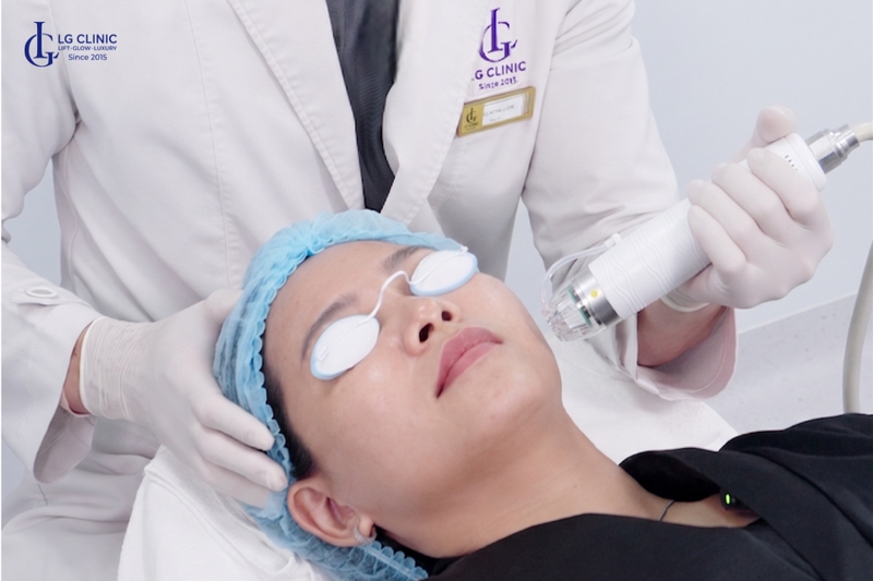 Cách trị lão hóa da bằng công nghệ RF