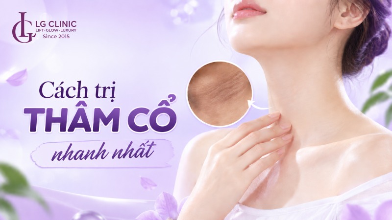 Cách trị thâm cổ nhanh nhất