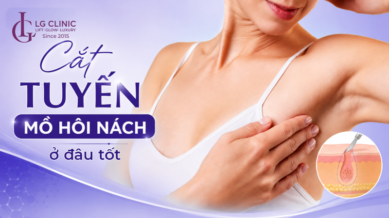 Cắt tuyến mồ hôi nách ở đâu tốt