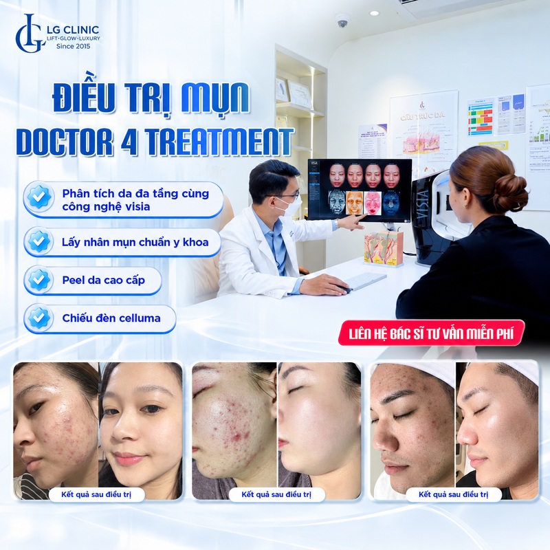 Điều trị mụn cùng với bác sĩ da liễu LG Clinic