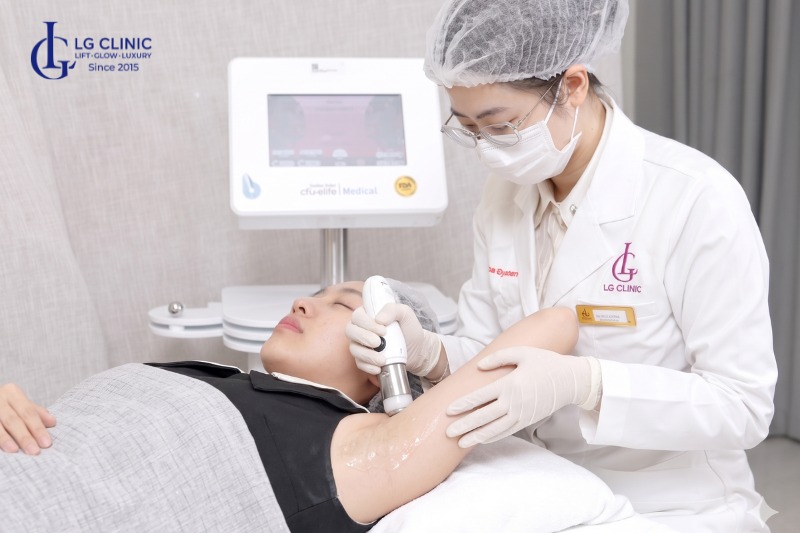 công nghệ trị hôi nách mới nhất