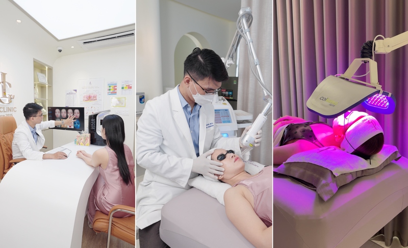 LG Clinic ứng dụng công nghệ thu nhỏ lỗ chân lông Deep FX Laser kết hợp VISIA và Celluma