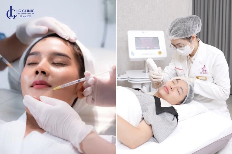 Sau 25 tuổi nên can thiệp thẩm mỹ nội khoa để phòng ngừa lão hoá