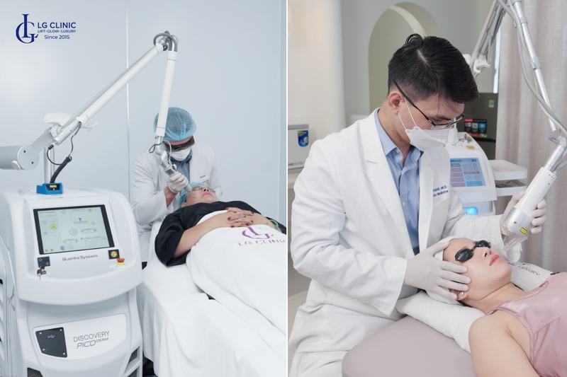 Điều trị sắc tố do lão hoá sớm bằng công nghệ laser hiện đại tại LG Clinic