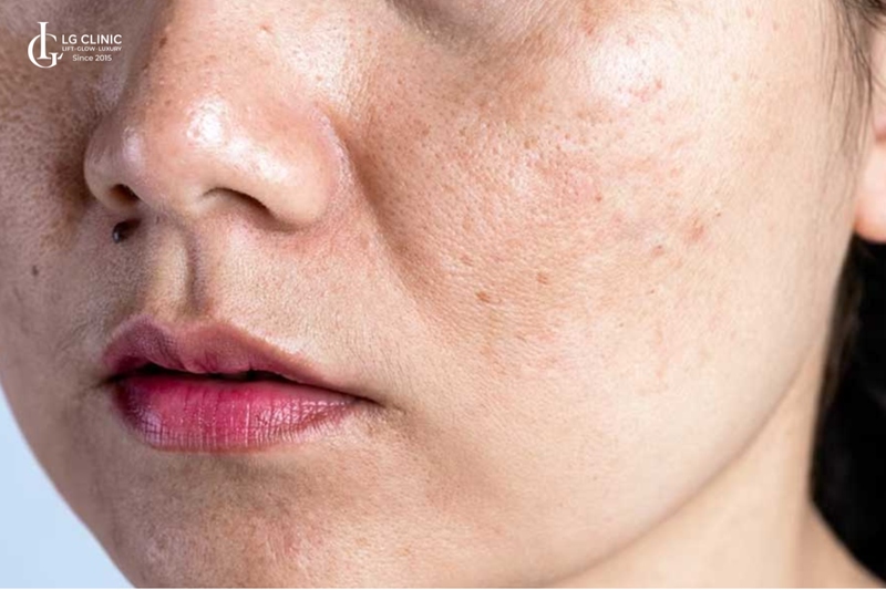 Các hiệu da lão hóa sớm