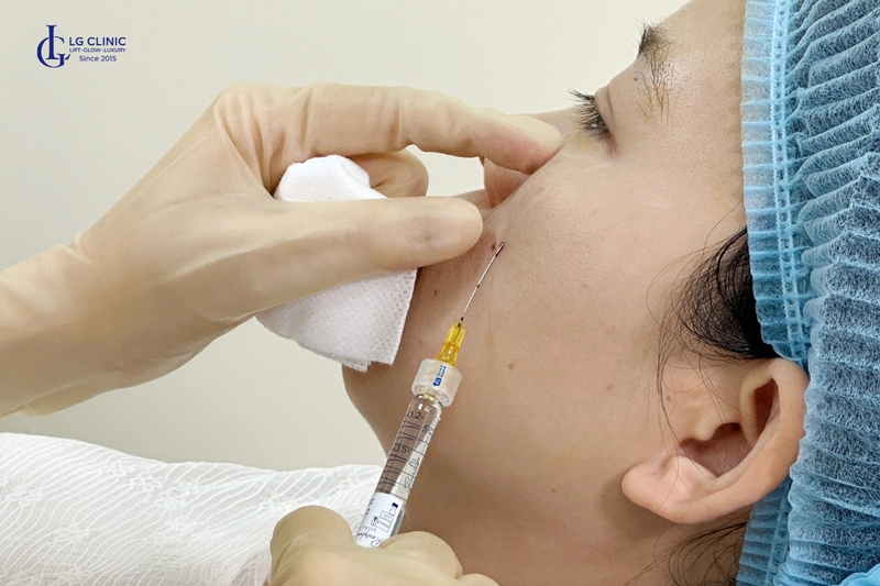 Tiêm filler, botox hoặc dưỡng chất phải do bác sĩ thực hiện 