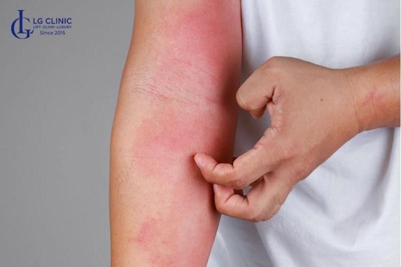 hậu quả tắm trắng phi thuyền