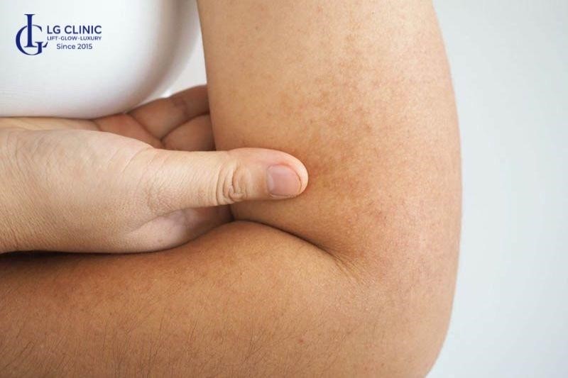 hậu quả tắm trắng phi thuyền