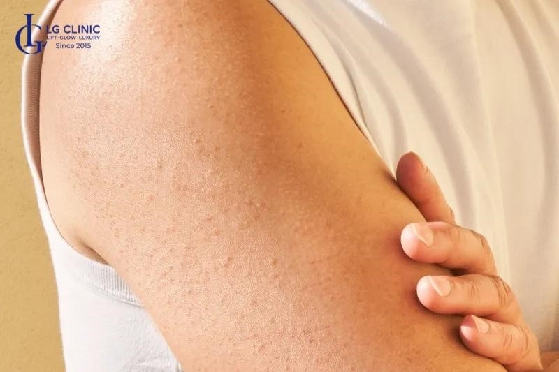 hậu quả tắm trắng phi thuyền