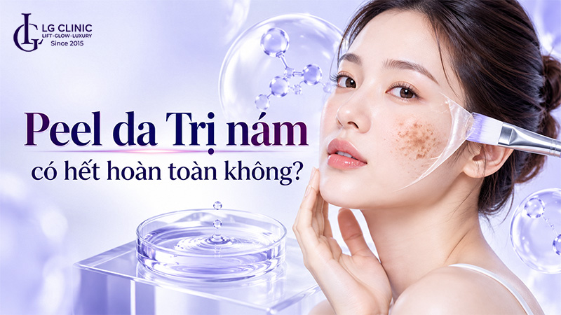 peel da trị nám