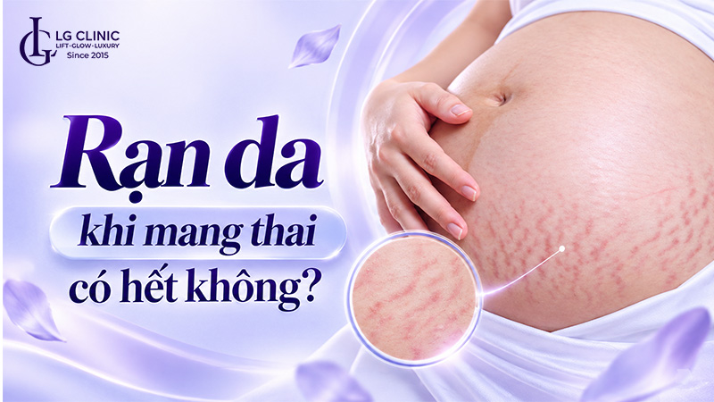 Rạn da khi mang thai có hết không