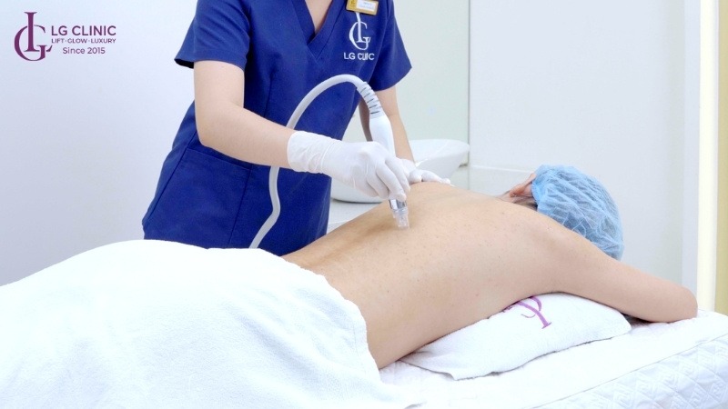 Spa trị mụn lưng Thủ Đức