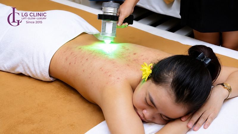 Spa trị mụn lưng Thủ Đức