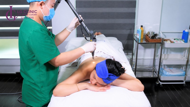Spa trị mụn lưng Thủ Đức