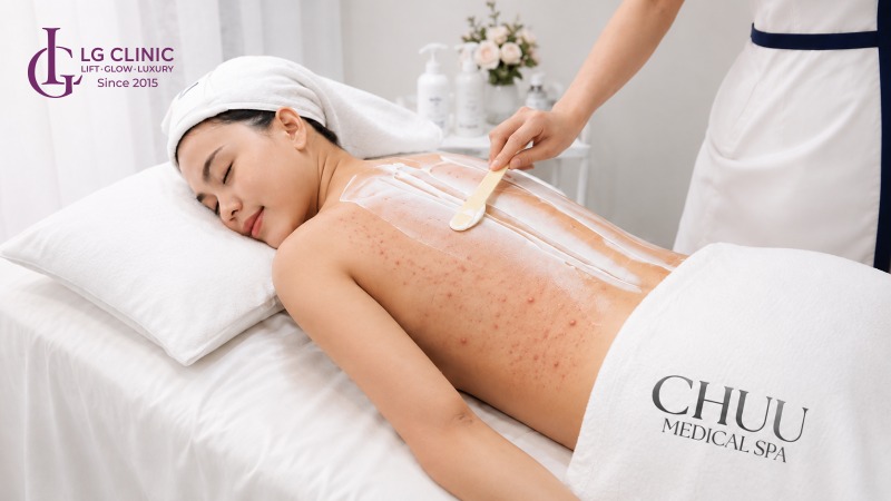 Spa trị mụn lưng Thủ Đức