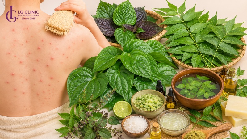 Tắm lá gì trị mụn lưng