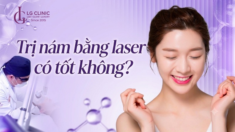 Trị nám bằng laser có hiệu quả không